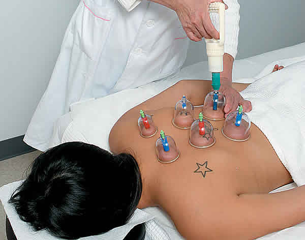 Russian Honey & Cupping Massage Course